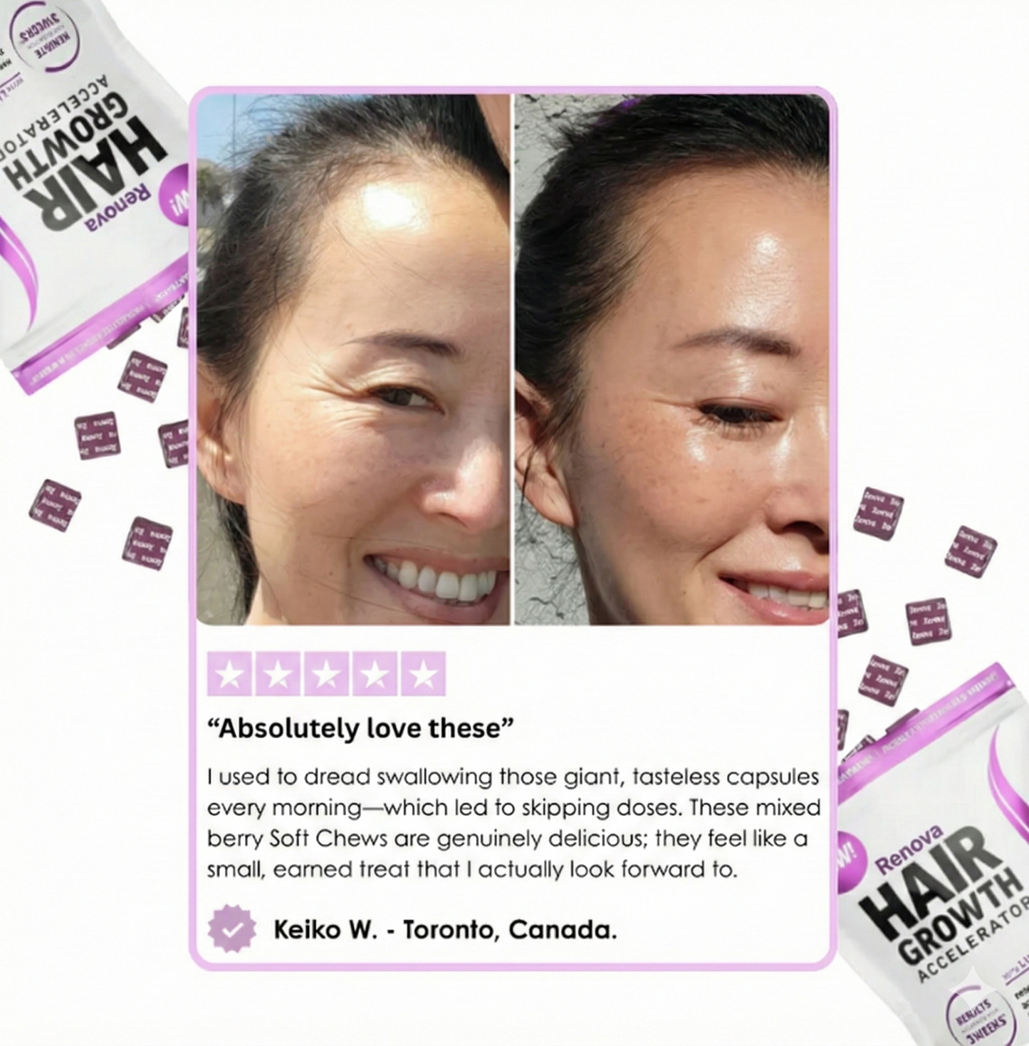 Tired of Thinning Hair & Clumps in the Drain? Renova Revitalizes Your Follicles From Within.